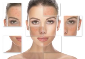 Queratosis seborréicas y verrugas